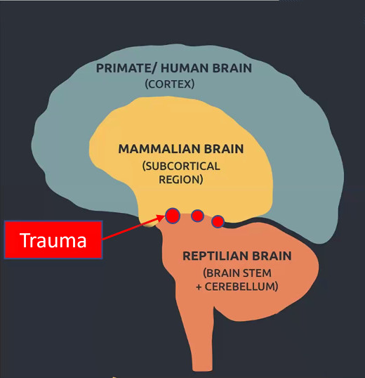 Capas del cerebro